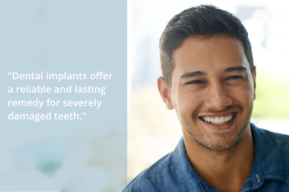 Dental implants from Prairie Star Dental offer a reliable solution for severely damaged teeth.