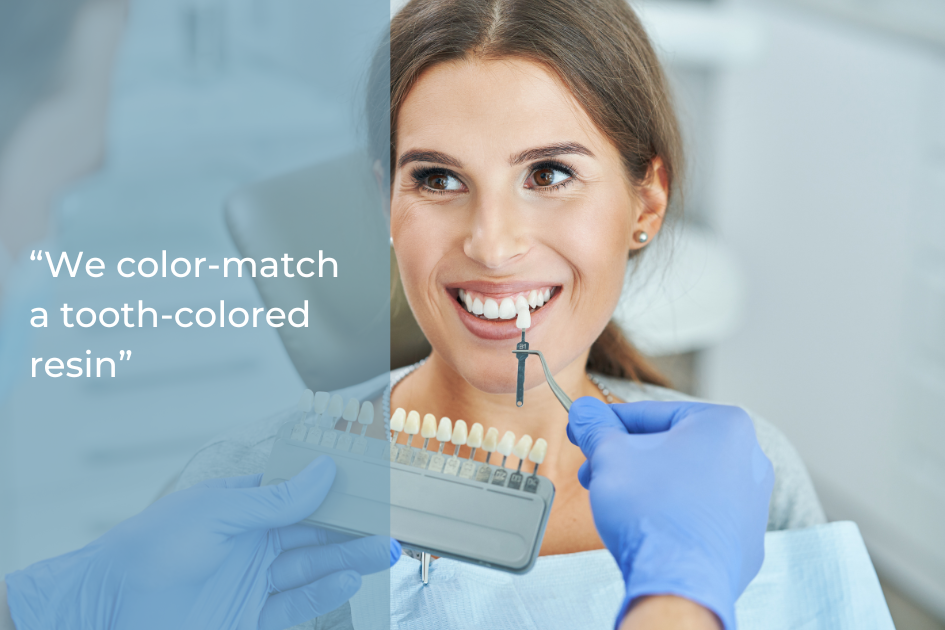 A dentist wearing blue gloves compares tooth shades to a smiling woman’s teeth in a dental office, showcasing cosmetic bonding and color-matching tooth-colored resin as advanced dental solutions.